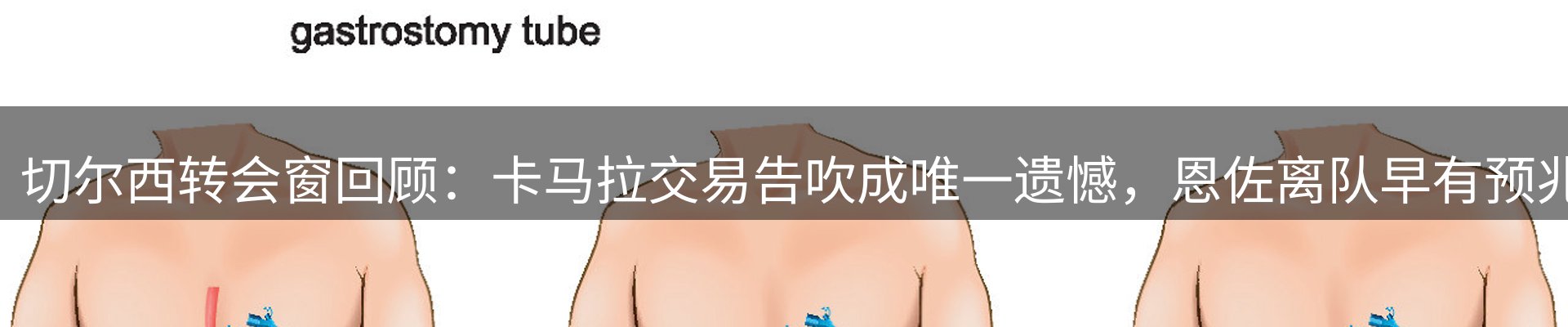 焦点选编