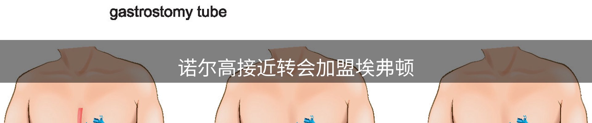 体育资讯